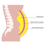 visceral fat surrounding abdominal organs illustration showing metabolic health risk